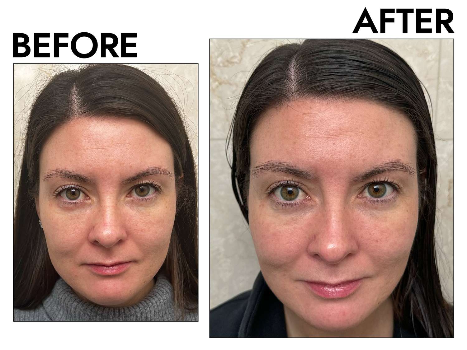Wrinkle + Texture Repair